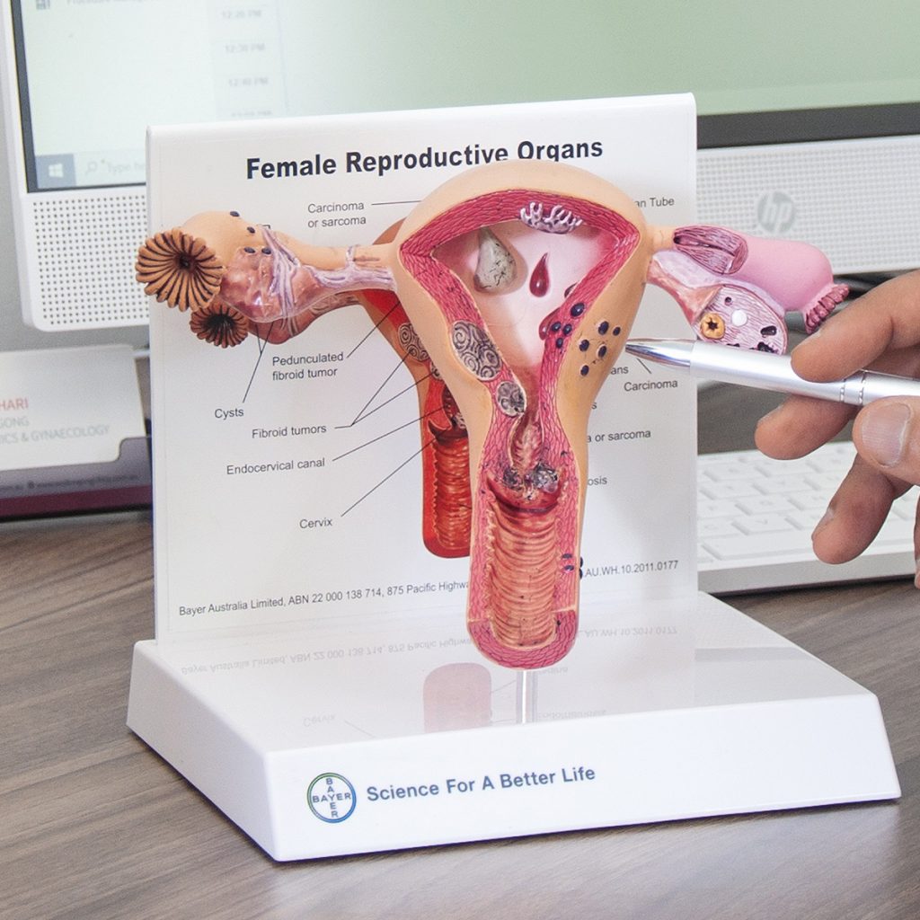 ⁂ Private endometriosis specialist near me ⁂ Private endometriosis specialist near me