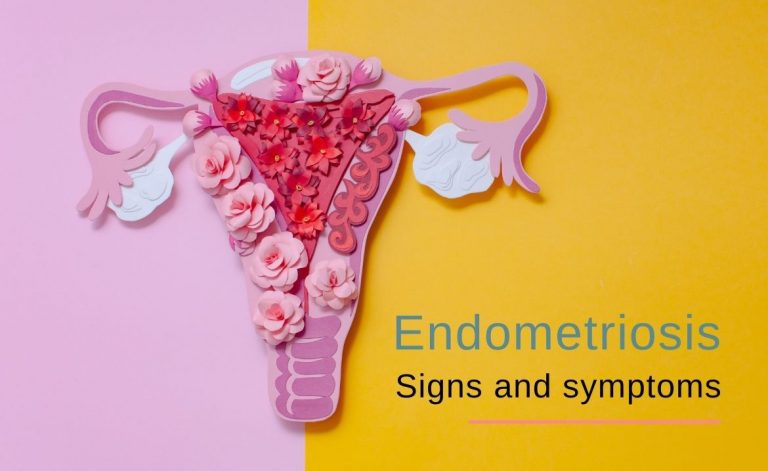 endometriosis