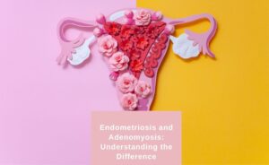Endometriosis and Adenomyosis