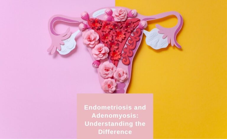 Endometriosis and Adenomyosis